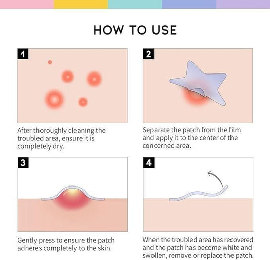 30 Pcs Pimple Patches – Fast-Healing, Invisible Spot Treatment