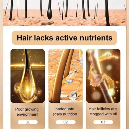 Anti Hair Loss Shampoo – Root Strengthening, Growth-Boosting & Deep-Cleansing Formula (600ml, Pack of 2)