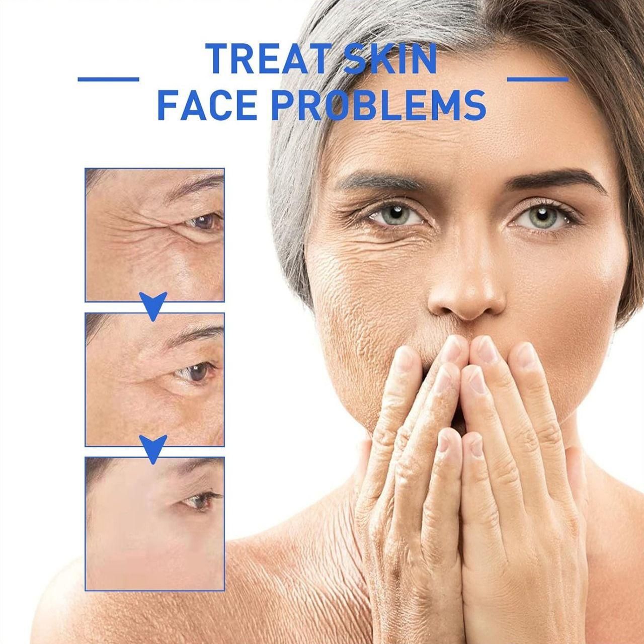 Botox Stock Solution Anti-Aging Collagen Serum (All Skin Types)