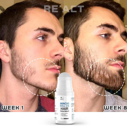 Minoxi Roll-On Hair Treatment – Nourishing Scalp Serum for Fuller, Healthier-Looking Hair