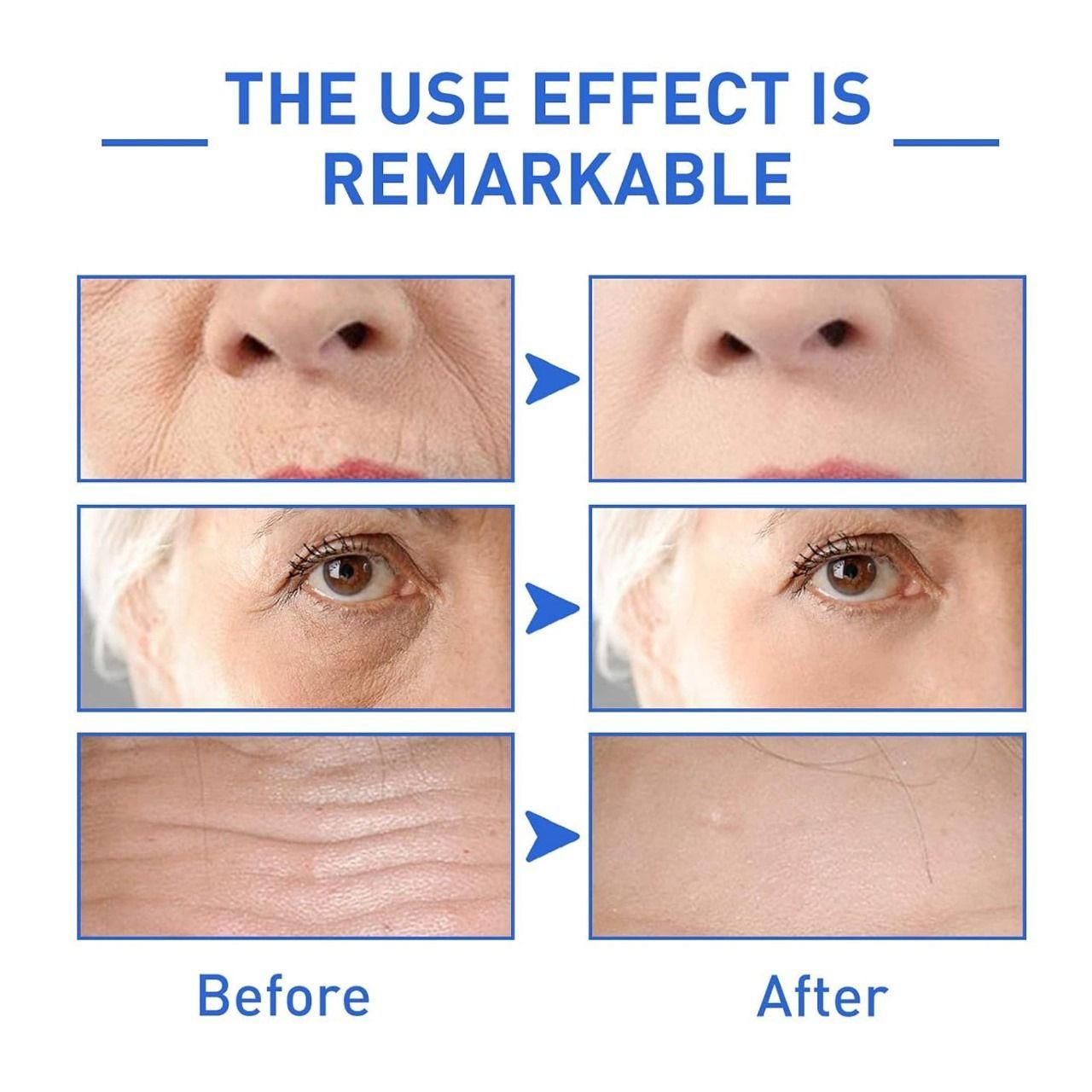 Botox Stock Solution Anti-Aging Collagen Serum (All Skin Types)