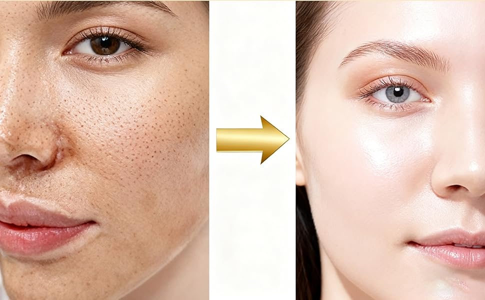 Gold Snake Venom Retinol Mask – Pore Purifying Treatment