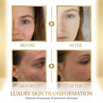 Gold Snake Venom Retinol Mask – Pore Purifying Treatment