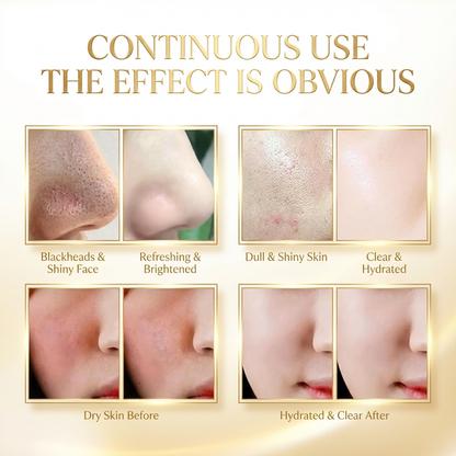 Gold Snake Venom Retinol Mask – Pore Purifying Treatment